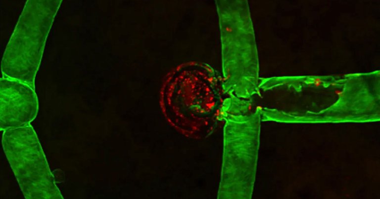 To come up with new ways to treat aneurysms and improve on existing treatments a team of researchers developed the first-ever living 3D-printed aneurysm.