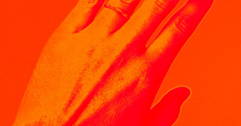 A team of scientists developed new wearable sensors that can be manufactured directly onto someone's skin — without burning the recipient in the process.