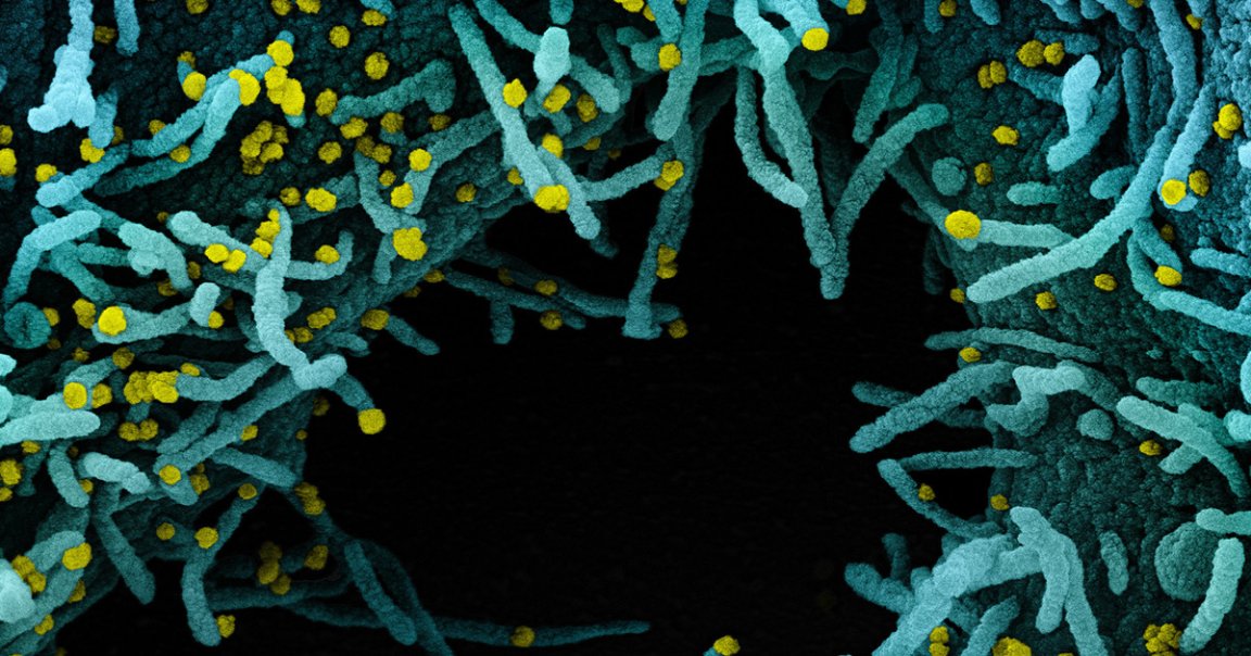 A woman died after catching the coronavirus, even though she had recovered from COVID-19 months prior. It's the first confirmed death linked to reinfection.