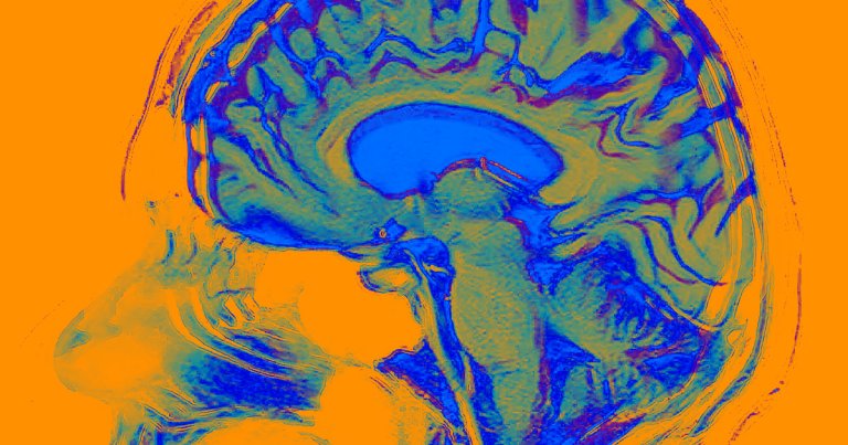Yet another study suggests there's a strong condition between COVID-19 and a variety of psychiatric and neurological conditions.