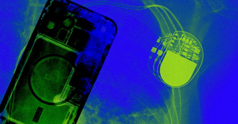 According to a new study published last week, an iPhone 12 can interfere with a pacemaker just by placing one close to the patient's heart.
