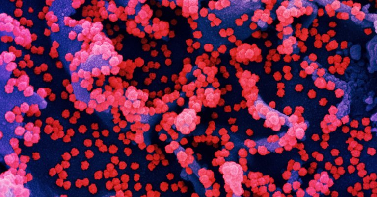 According to UK experts, the fast spreading B117 variant of the coronavirus may increase the death rate by 30 to 40 percent.