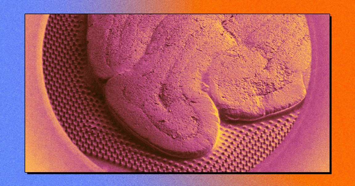 Scientists are attaching human brain stem cells to microchips in an attempt to make artifiical intelligence more powerful and efficient than before.
