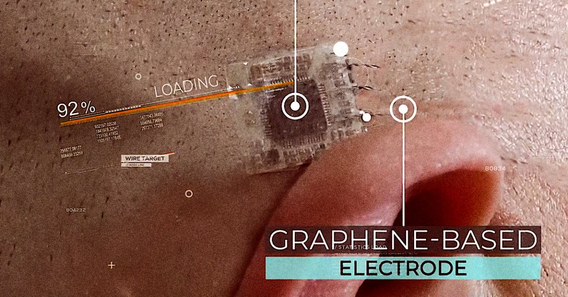 A company Brain Scientific is developing an "e-tattoo" that can be injected under the skin in epilepsy patients and scan their brains for looming seizures.