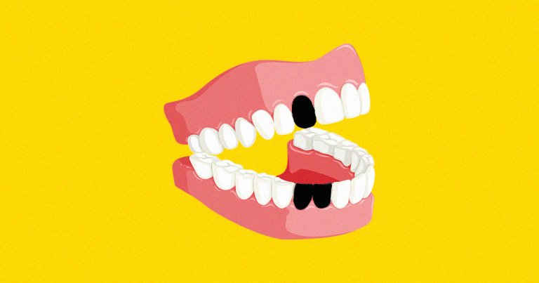A man's vape exploded in his mouth, burning his mouth and shattering several of his teeth, according to a new case report.