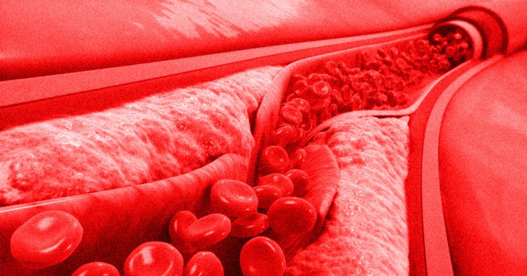 COVID-19 vaccine manufacturer AstraZeneca went on the defensive after countries halted the rollout of its vaccine over fears it may cause blood clots.