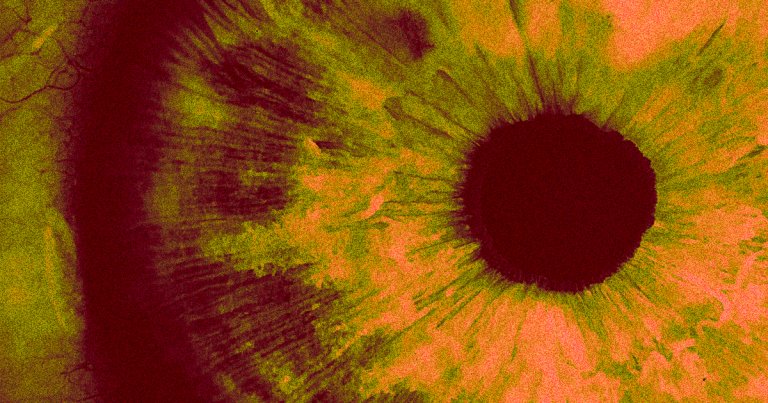 Scientists accidentally discovered that their experimental gene therapy could restore a blind patient's vision for over 15 months.