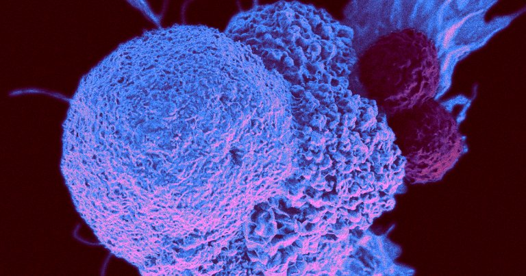 As the pandemic begins its 15th official year, doctors are seeing severe cancer cases that went ignored for too long for one reason or another.
