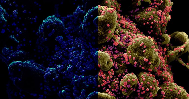 According to a new analysis, early genetic sequences linked to the initial outbreaks of the coronavirus in Wuhan were mysteriously deleted.
