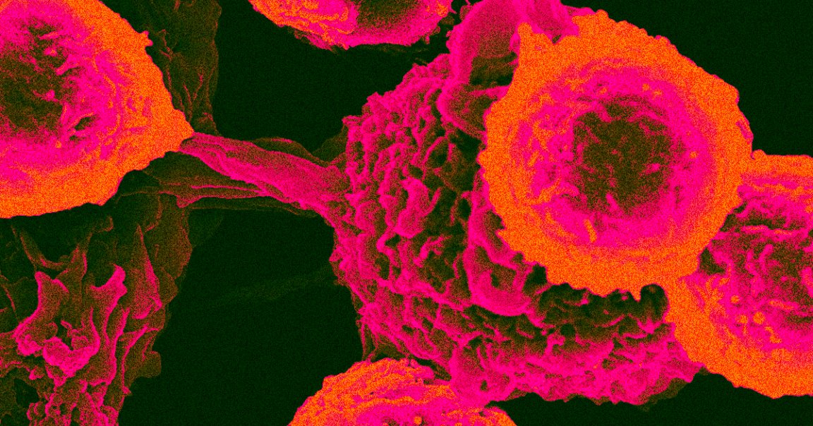 Scientists were able to lump every kind of cancer out there into two categories based on whether they express a single protein.