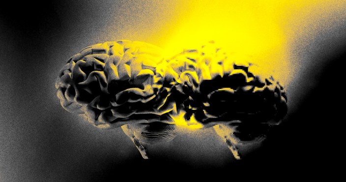 People With Half Their Brain Removed Are Doing Surprisingly Well