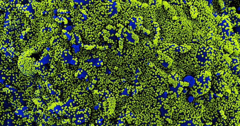 Preliminary research suggests a possible answer for why the delta variant of COVID-19 is so much more infectious than others.