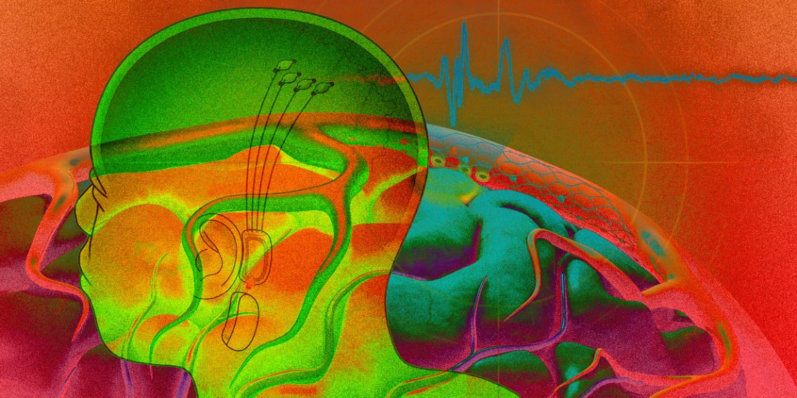 Synchron CEO and founder Thomas Oxley explains how his neural implant startup beat Neuralink in the race to achieve FDA approval.