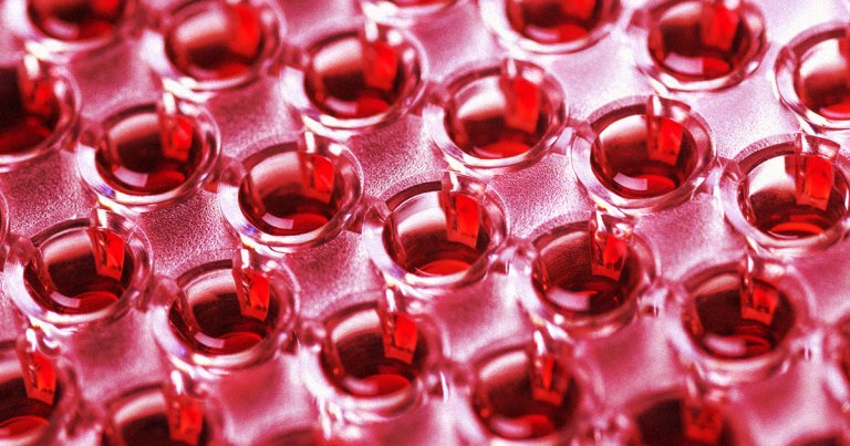 Chinese authorities are about to test blood samples from Wuhan to investigate where and when the first COVID-19 outbreaks began.