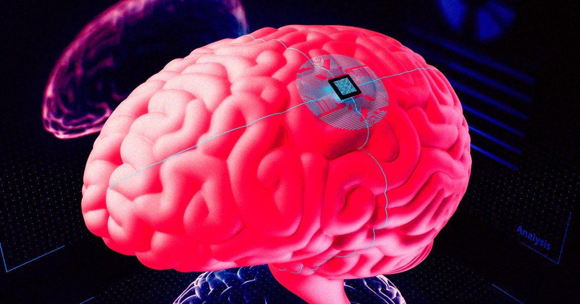 A brain implant that zaps a woman's brain 300 times per day treated her severe depression after medications failed for years.