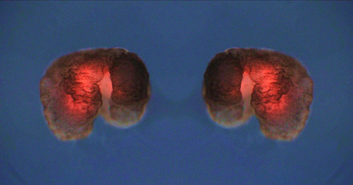 Scientists have created synthetic organisms known as "Xenobots" that can self-replicate — a striking leap forward in synthetic biology.