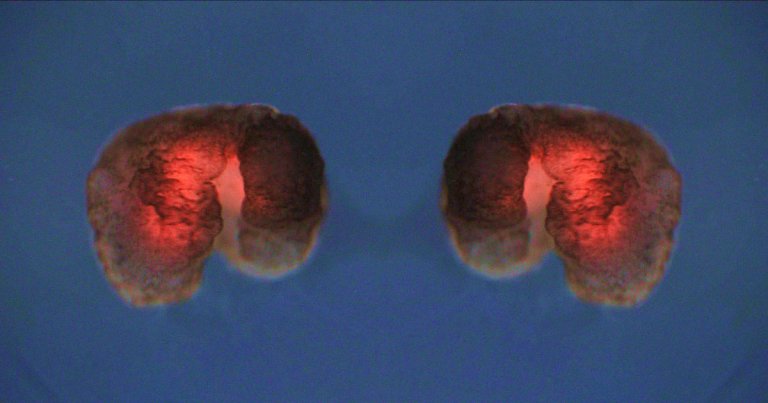 Scientists have created synthetic organisms known as "Xenobots" that can self-replicate — a striking leap forward in synthetic biology.