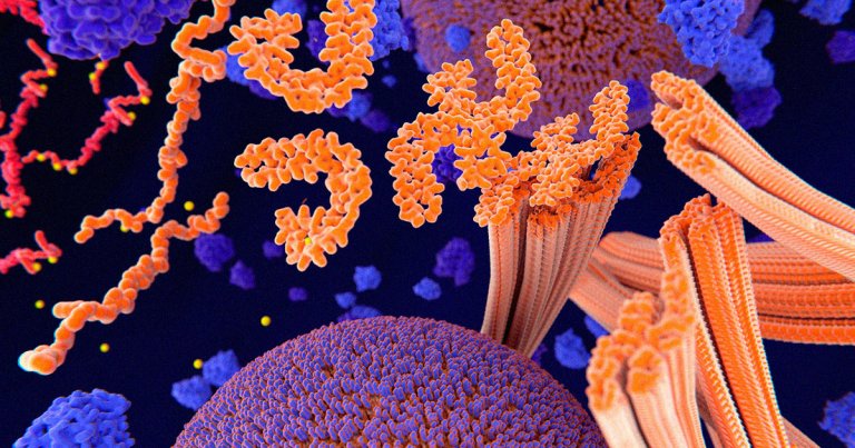 Researchers may have found the molecular-level cause for Alzheimer's by looking deeper into the DNA tangles in the brains of dementia patients. 