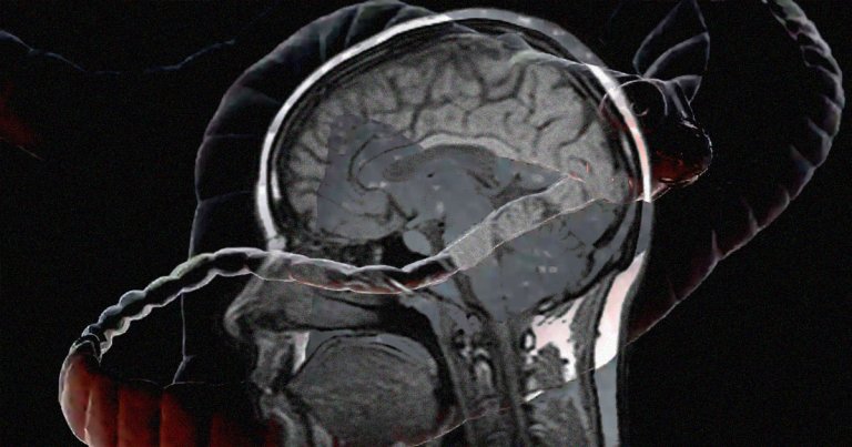 Doctors discovered a Massachusetts man who had tapeworms burrowed into his brain after ingesting feces-contaminated food years before.