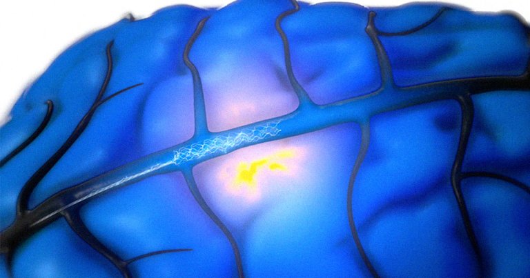 Australian brain computer interface company Synchron allowed a 62-year-old man with ALS to turn his thoughts directly into tweets.