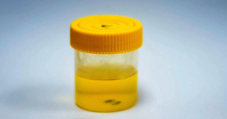 Anti-Vaxxers Are Drinking Human Urine for Some Disgusting Reason
