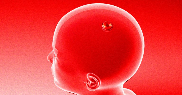 Elon Musk’s Neuralink Is an Absolute Disaster, Former Employees Say