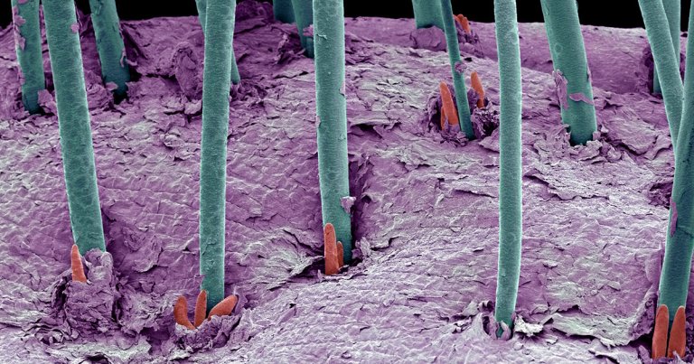 Ernesto Lujan, a biologist and founder of medical startup dNovo, says his company has successfully transplanted human hair stem cells onto a mouse.