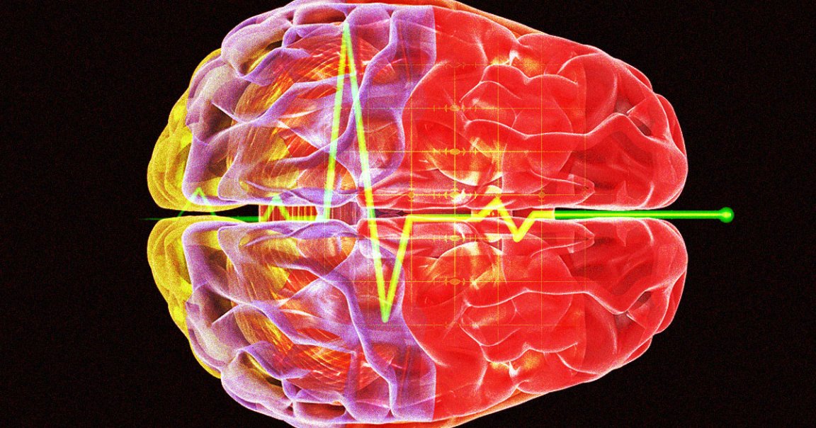 A team of scientists had the opportunity to study the brain waves of a dying person — and found an increase in activity associated with memory and dreams.