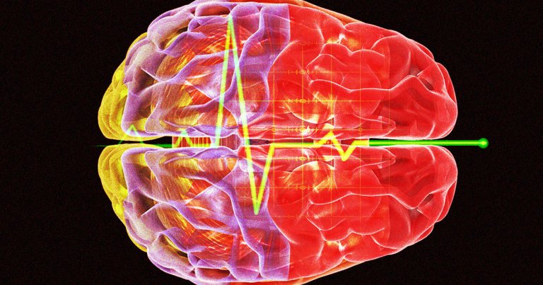 A team of scientists had the opportunity to study the brain waves of a dying person — and found an increase in activity associated with memory and dreams.