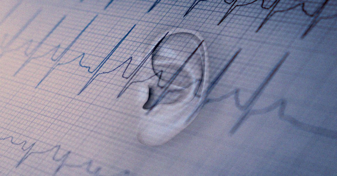 A startup called NextSense is working on a pair of earbuds that can record the electrical signals of the brain to study sleeping and mental conditions.
