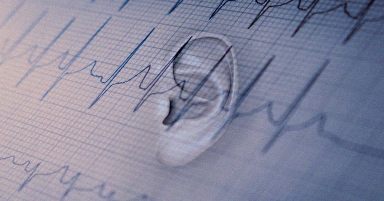 A startup called NextSense is working on a pair of earbuds that can record the electrical signals of the brain to study sleeping and mental conditions.