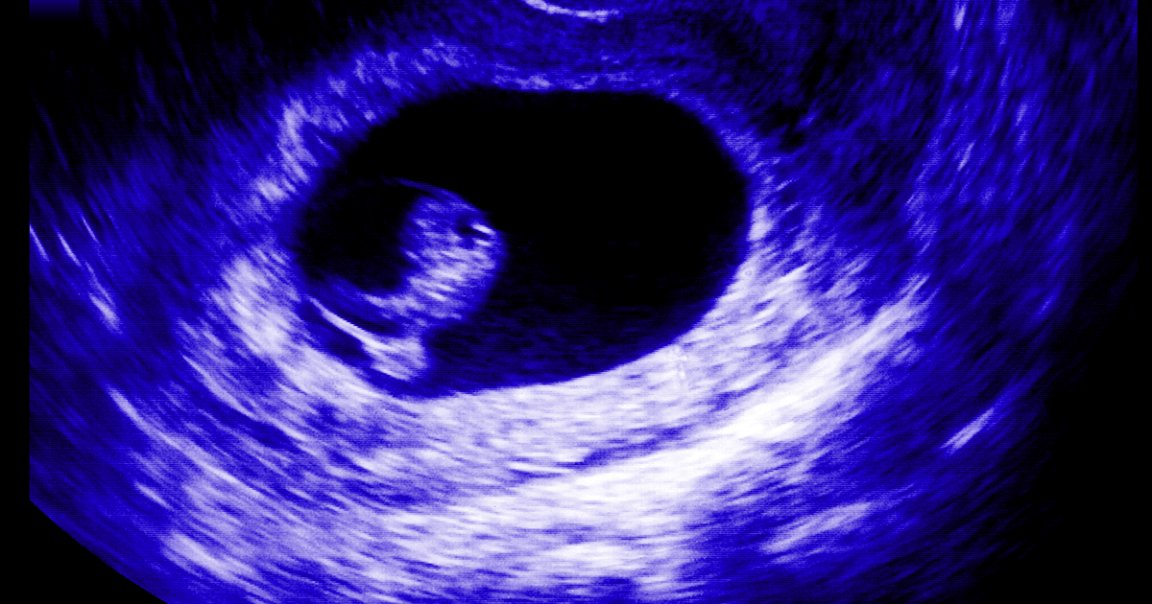 Police found five deceased fetuses in the DC home of a Progressive Anti-Abortion Uprising anti-choice activist who had already been arrested five times.
