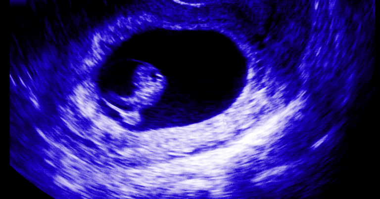 Police found five deceased fetuses in the DC home of a Progressive Anti-Abortion Uprising anti-choice activist who had already been arrested five times.