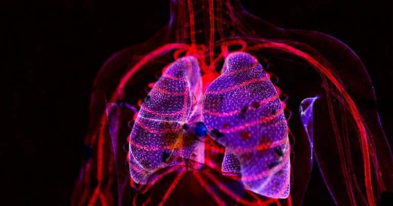 Scientists have discovered polluting microplastic in the lungs of living people for the first time, more proof that the particles are practically everywhere.