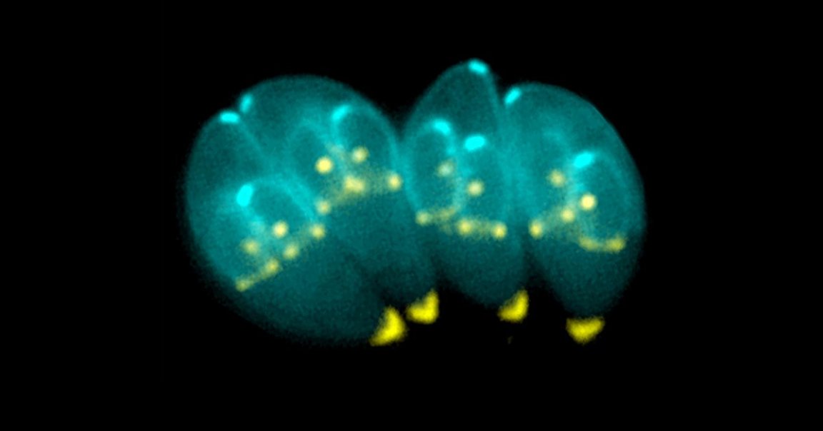 Scientists have found a new avenue for finding out whether someone's been exposed to the world's preeminent parasite — by looking at their eyeballs.