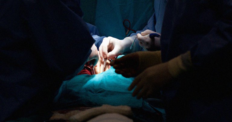 A team of surgeons at NYU Langone successfully transplanted genetically engineered pig hearts into two patients who were recently declared deceased from brain death.