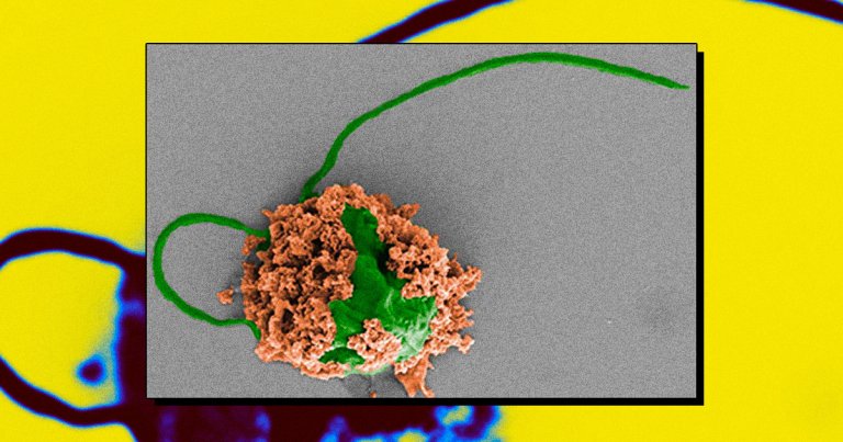 Nanoengineers at the UC Davis have officially developed microbots that can swim around a mouse's lungs and deliver pneumonia-clearing medicine.