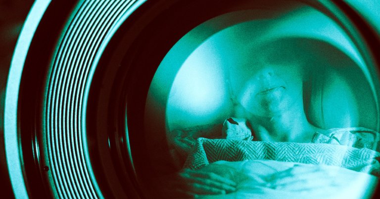 An AI artist unexpectedly discovered that private medical photos from over ten years ago were included in the AI training image database LAION.