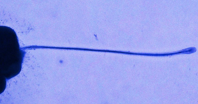 In what could be a groundbreaking treatment for hair loss, Japanese scientists have, for the first time ever, grown hair follicles in a lab.