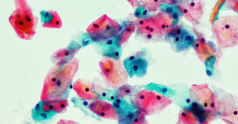 A team of bioengineers have created a "vagina on a chip" made from donated vaginal cells to mimic key features of the vaginal microbiome, The New York Times reports.