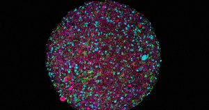 A team of scientists has grown "minibrains" in a lab with the eventual goal of linking them together to form super-efficient "biocomputers."