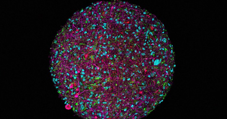 A team of scientists has grown "minibrains" in a lab with the eventual goal of linking them together to form super-efficient "biocomputers."