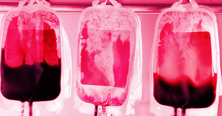 An eccentric millionaire obsessed with staying young forever has apparently taken to getting blood transfusions from his teen son.