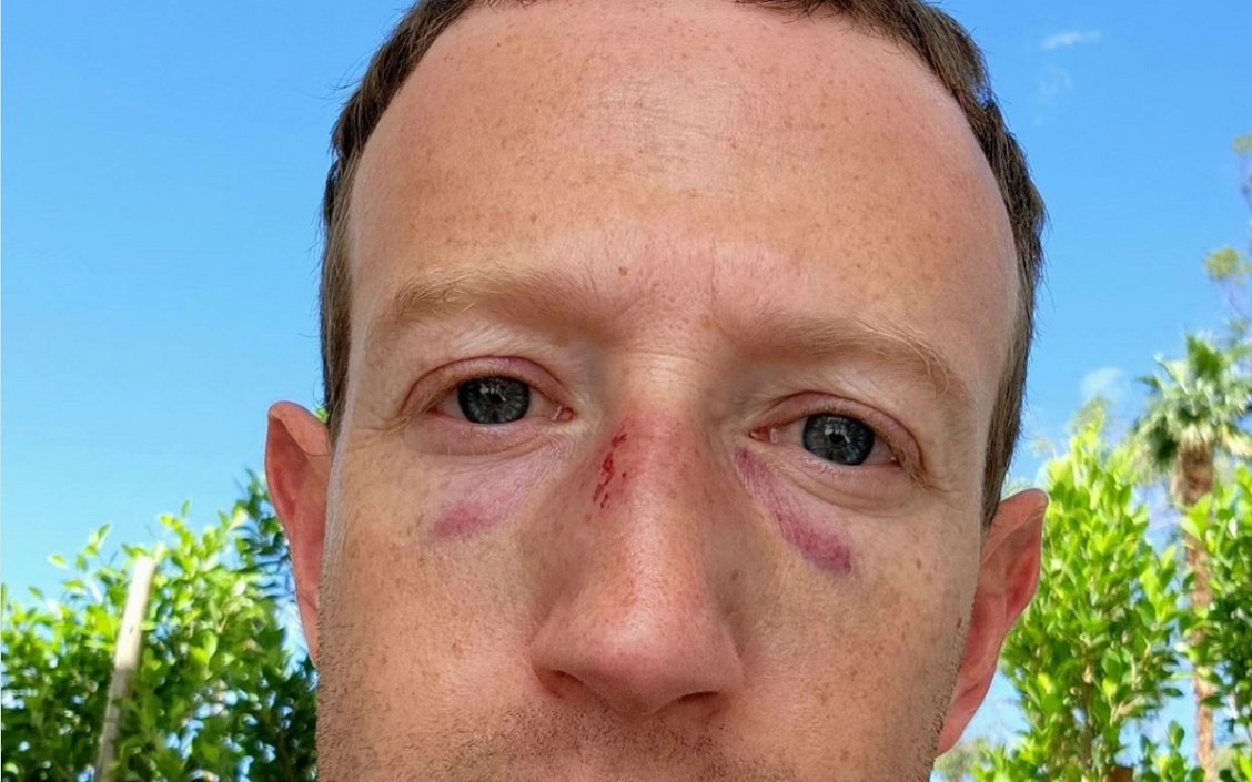 Mark Zuckerberg Got Busted in the Face