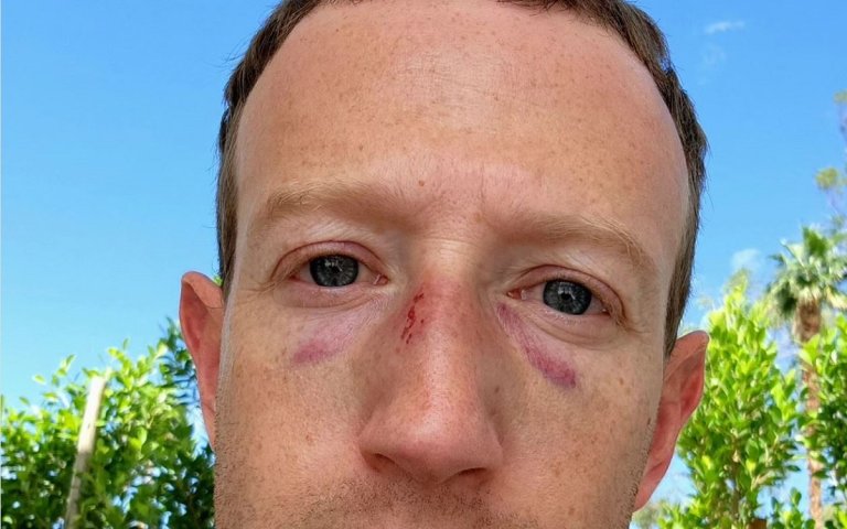 Meta-formerly-Facebook CEO Mark Zuckerberg, an avid jiu-jitsu devotee, took to Instagram to show off recent training trophies: two black eyes.