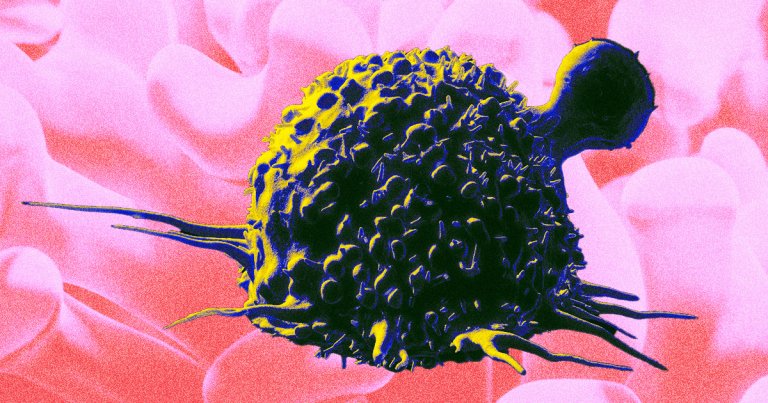 Young people are getting diagnosed with cancer at rates higher than ever before — and doctors are stumped as to why.
