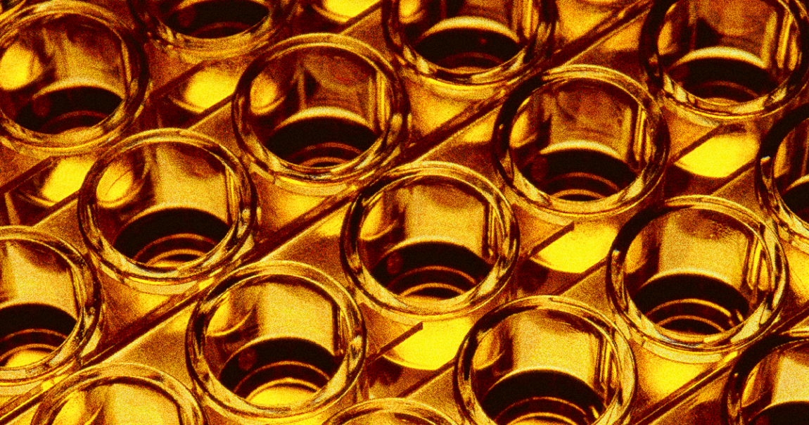 Until now, scientists didn't know what exactly made pee yellow — and the answer seems to be situated a bit north of the bladder after all.