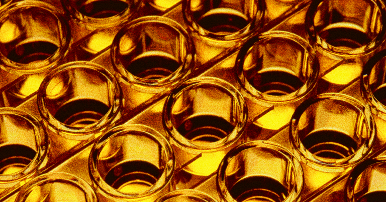 Until now, scientists didn't know what exactly made pee yellow — and the answer seems to be situated a bit north of the bladder after all.