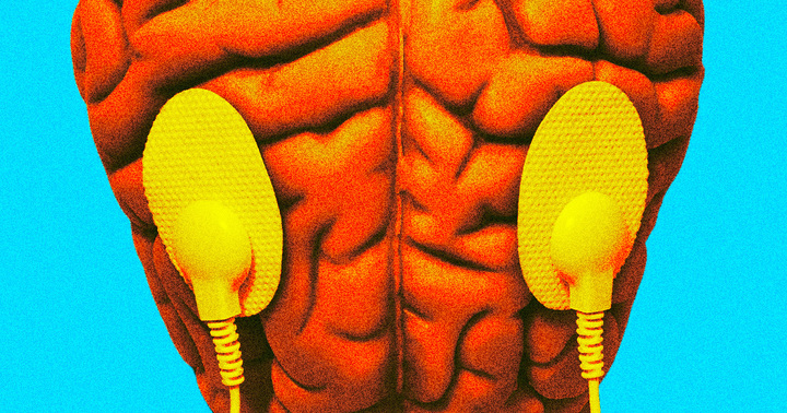Stanford University researchers have discovered how to use magnetic pulses to make patients more easily hypnotizable.