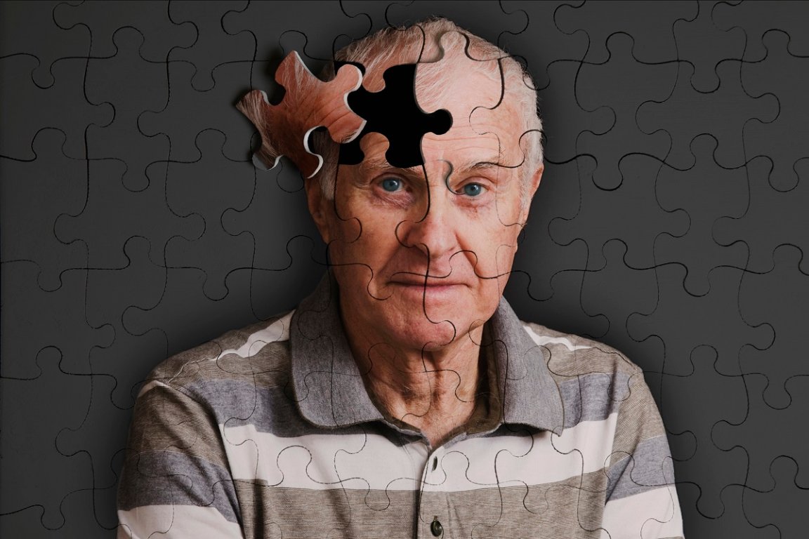 Researchers found that certain lifestyle choices warded off dementia symptoms in patients whose brains already contained Alzheimer's makers.